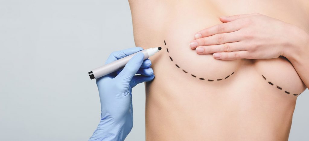 Breast surgery prep | Featured image for Breast Enlargement: Improving Confidence blog Brisbane Cosmetic Clinic