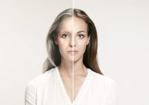 Before and after facial rejuvenation photo | Featured image for Infini with PRP blog.
