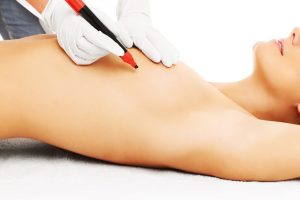Breast Surgery Prep | Featured image for The Types of Breast Surgery – Like Breasts – Come in Many Forms blog Brisbane Cosmetic Clinic