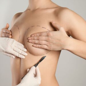Lady holding her breast | Featured image for does Medicare cover breast reduction.